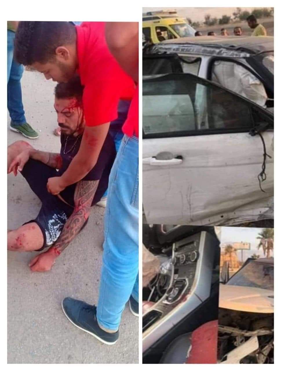 نقل عمرو زكي للمستشفى بعد حادث خطير (صور)