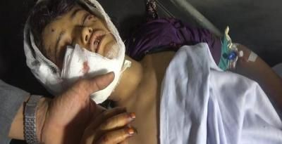 أخبار اليمن : جرائم العدوان في مثل هذا اليوم 18 أكتوبر