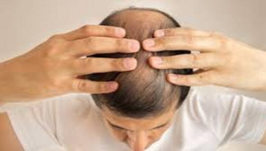 وداعاً لتساقط الشعر ومشكلة الصلع .. عشبة تحل جميع مشاكل الشعر بسرعة فائقة!