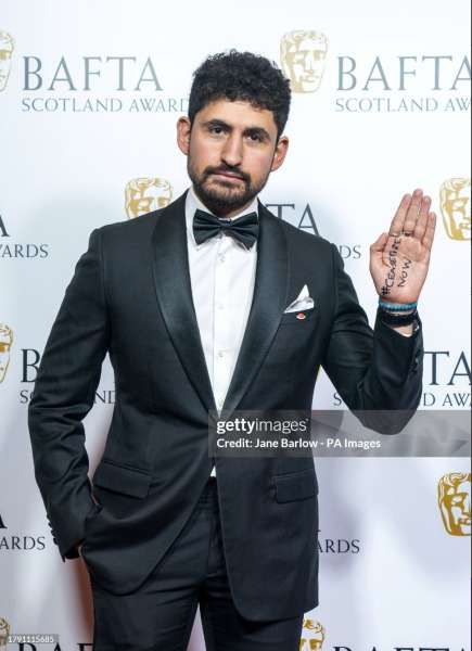 أمير المصري يدعو لوقف إطلاق النار في غزة في حفل بافتا اسكتلندا