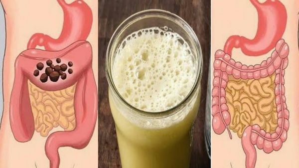 ذكر في القرآن الكريم .. مشروب يعالج القولون والإمساك في أيام قليلة