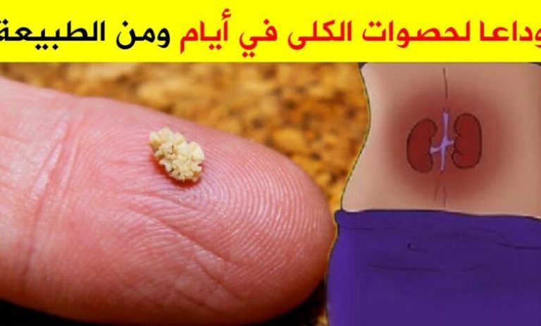 طريقه طبيعية تحمي الجسم من الحصوات والأملاح وطرد السموم من الجسم بدون أدويه