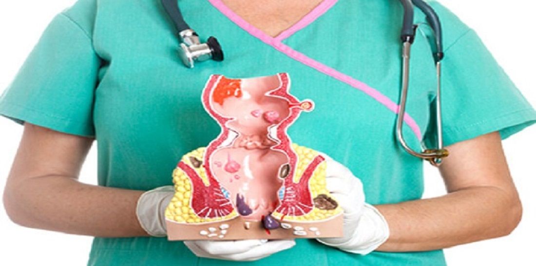 حل سحري ونهائي لعلاج البواسير الداخلية والخارجية .. وداعا للجراحة