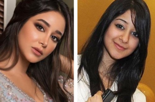 النجمات قبل وبعد التجميل