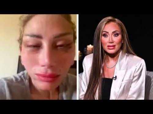 تنبؤات ليلى عبد اللطيف لأطباء التجميل تحققت في وجه ريهام سعيد.. ايه الحكاية