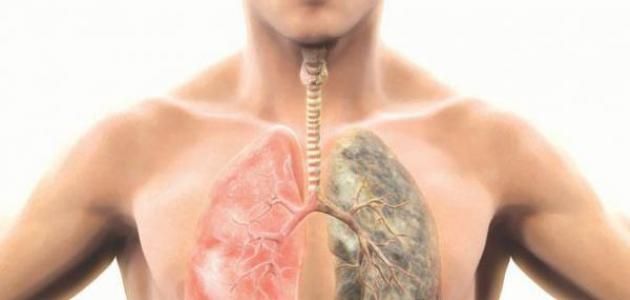 دراسة تفجر مفاجأة.. لماذا يصاب بعض المدخنين بسرطان الرئة والبعض الآخر لا يصاب