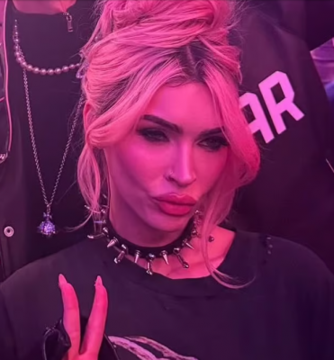 ميغان فوكس بملامح صادمة بسبب عمليات التجميل