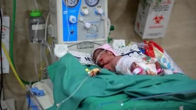 أخبار اليمن : صحة غزة: وفاة رضيعين نتيجة الجفاف وسوء التغذية