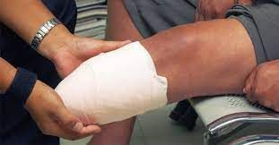 اغرب من الخيال ..رجل يستأجر شخص ليقطع ساقيه لسبب صادم لايصدقة عقل