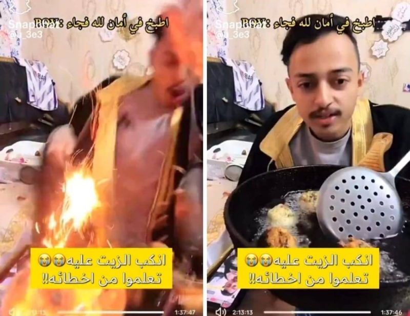 شاب يسكب الزيت المغلي عليه بالخطأ أثناء بث مباشر : اتفرج