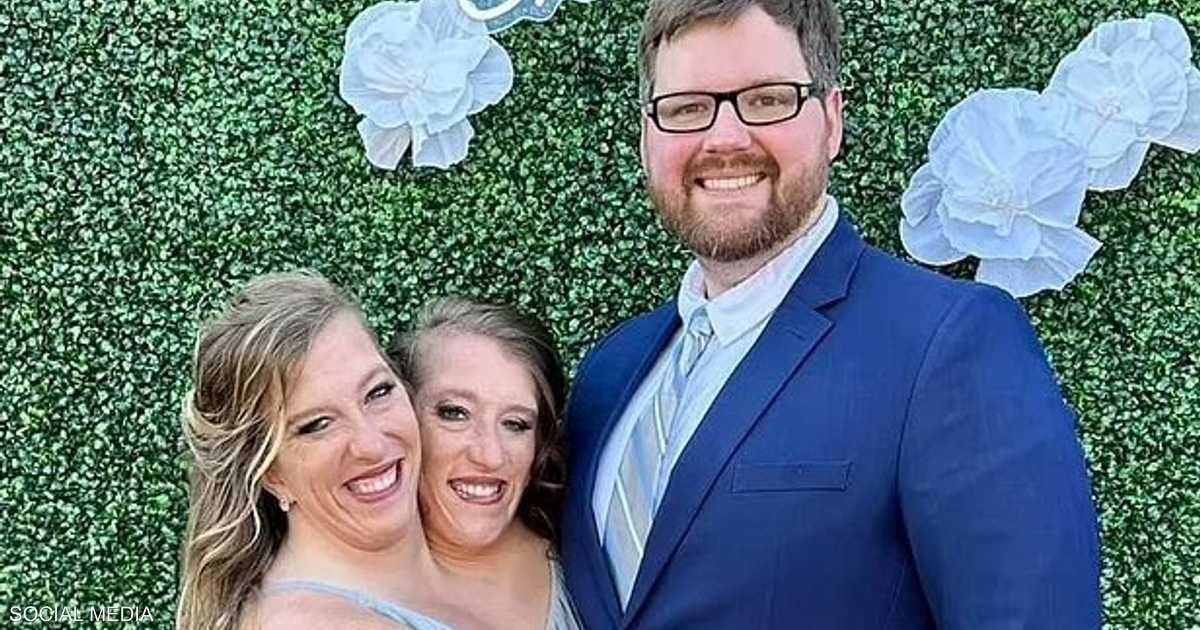 العالم اليوم - بالصور.. زواج التوأم الملتصق الشهير آبي وبريتاني