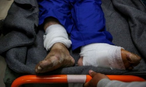 بعلامات تعذيب على أجسادهم .. الاحتلال يفرج عن نحو 50 أسيرًا من غزة