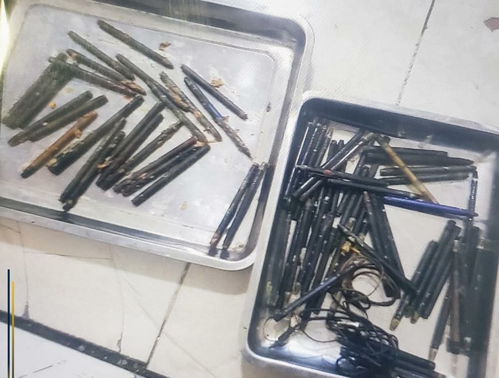 ستنصدم!..لن تصدق ما عثر عليه الاطباء في معدة مريض يمني في صنعاء؟..اتفرج