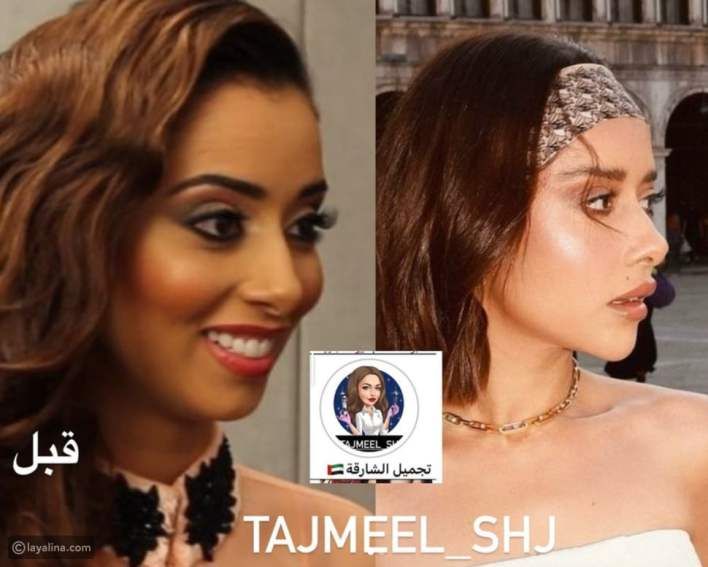 اتفرج كيف أصبحت..صورة صادمة لـ‘‘بلقيس فتحي’’ قبل وبعد التجميل.. لن تتمكن من معرفتها ؟