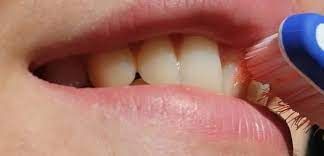 جربها الأن..لتبييض الاسنان كالؤلؤ فى دقيقتين فقط وطرد الرائحة الكريهة وازالة الاصفرار والجير