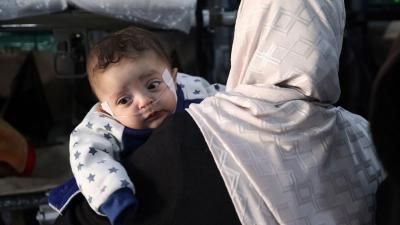 أخبار اليمن : الأونروا: 40 ألف إصابة بالتهاب الكبد في غزة