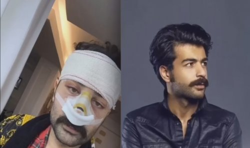 صوة عقيل الرئيسي قبل وبعد التجميل تتصدر الترند