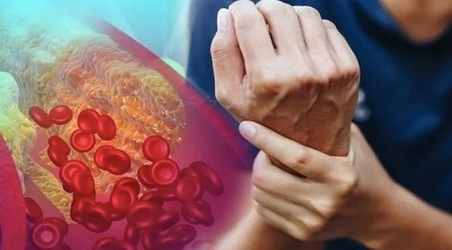 سم قاتل.. اسوأ طعام يتسبب في ارتفاع الكوليسترول بشكل خطير للغاية !