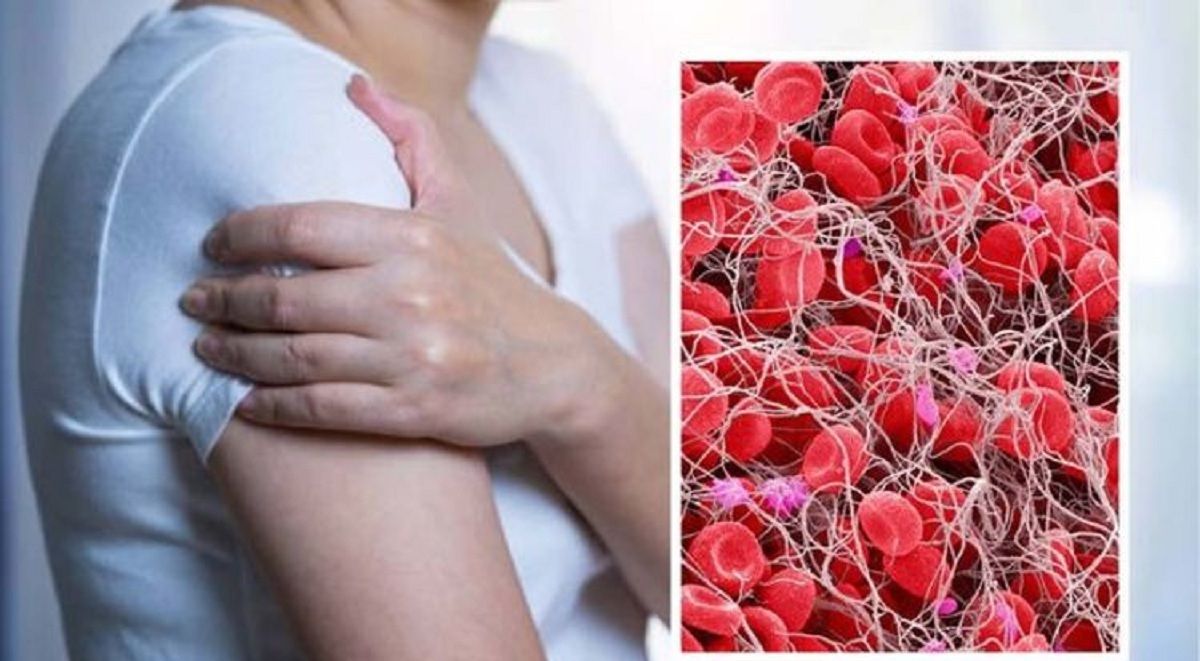 أربع علامات على ذراعك تدل انك تعاني من تجلط الدم.. احذرها قبل فوات الأوان