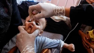 أخبار اليمن : تطعيم 355 ألفاً ضد شلل الأطفال في غزة