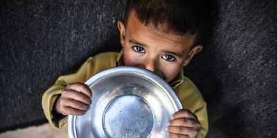 أخبار اليمن : الجوع يلتهم 37 طفلاً في غزة
