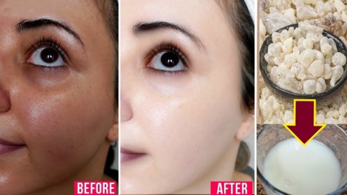 «مفيش احلا من كده بجد»... طريقة عمل كولاجين طبيعي لشد البشرة والتخلص من التجاعيد في دقائق هتصغري 20 سنة!!