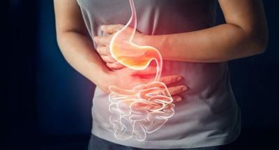 كيف يمكن التخلص من حرقة المعدة؟