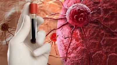 أخبار اليمن : أعراض سرطان الدم في المراحل المبكرة