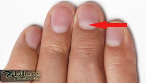 السؤال الذي حير الملايين.. ماذا يعني هذا الهلال الأبيض على الأظافر؟