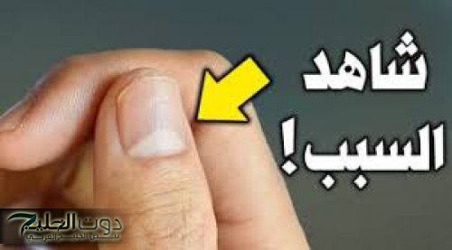 «ازاي عايشين ومانعرفش!!»... ماذا يخبرك الهلال والبقع البيضاء الموجودة على أظافرك عن صحتك؟؟ | حقائق صادمة سوف تدهشك!!