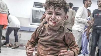 أخبار اليمن : اليونيسف: أطفال غزة يموتون بسبب تناقص الإجلاء الطبي