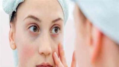 أخبار اليمن : تعرف على مشاكلك الصحية.. من وجهك!