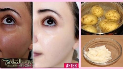 “حياتك هتتغير بحبة بطاطس”.. طريقة تحضير كريم البطاطس الجبار لتفتيح البشرة| سر جمال العرايس