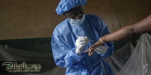 تخصيص نحو مليون جرعة من لقاحات إمبوكس لـ9 دول إفريقية