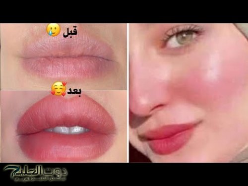 خلي جوزك يتجنن عليكي.. 6 وصفات طبيعية لتوريد الشفاه وتقشيرها بعد اول استخدام لهذه الوصفة.. سحرية ورائعة ومش هتستغني عنها