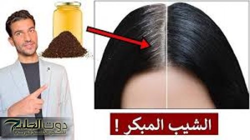 "هيرجع العجوزة صبيه".. خبير سعودي يكشف عن وصفة مبتكرة للتخلص من الشعر الأبيض في الرأس من أول استخدام .. حل سحري ومضمون 100% !!