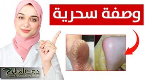 «سر جمال كعب الهوانم ».. طريقة سحرية للقضاء على التشققات في الكعبين وازالة الجلد الميت في ثواني فقط ومن أول مره .. مستحيل تخطر على بال العفريت نفسه!!