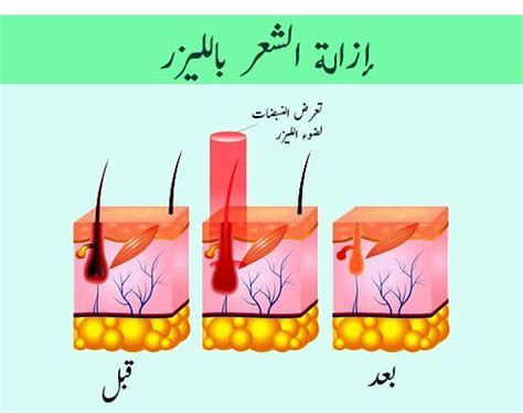 تجربتي مع نايت كالم
