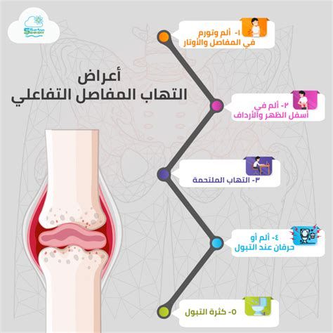 أفضل دواء لالتهاب المفاصل