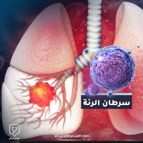 ألم في القلب وخلف الظهر