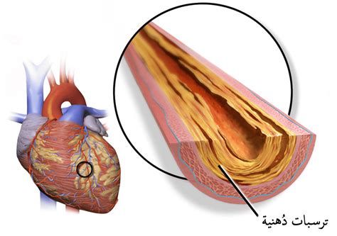 أعراض مرض القلب عند الشباب