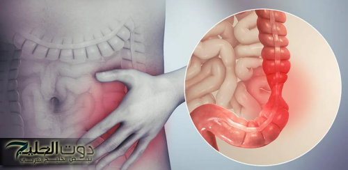 عشبة السنا الحل السحري لتنظيف القولون وتعزيز صحة الجهاز الهضمي!!..5 فوائد فعالة لعلاج القولون عند استخدام عشبة السنا..صحتك هتتغير كليا!!