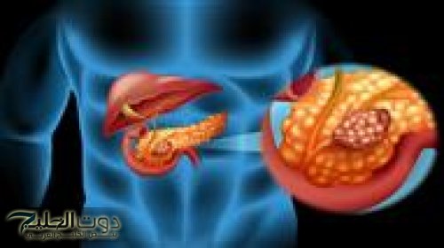 عشان متجيش تقول معرفش!!..5 علامات يجب الحذر منها لانها علامة تحذيرية علي تواجد مرض السرطان..أعرفها واحمي صحتك!!