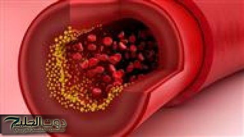 "عشبة معجزة برخص التراب: تناولها بهذا الشكل وارجع لسن الـ20 حتى لو كنت 70!"