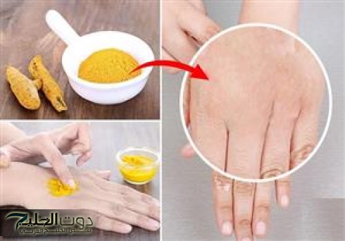 طرق التخلص من جفاف البشرة في الشتاء بوصفات طبيعية غير مكلفة