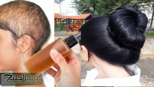 في 7 أيام تطويل الشعر بخلطة سحرية تزيد من نمو الشعر وتغذيته
