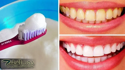 4 وصفات طبيعية لتبييض الأسنان بمكونات منزلية واقتصادية سريعة