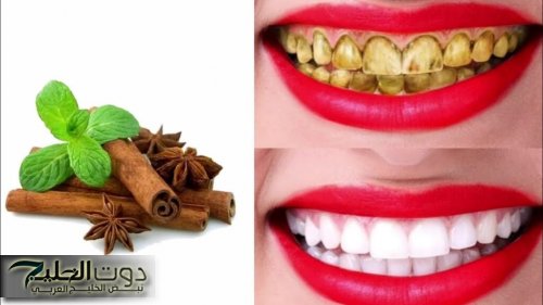طريقة عمل خلطة القرنفل المعجزة في تبييض الأسنان وإزالة الروائح الكريهة