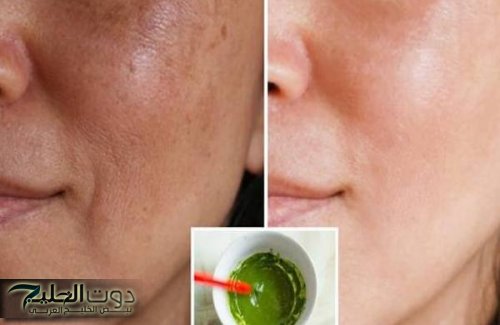 أسهل طريقة لعمل كريم البقدونس المدهش في إزالة التجاعيد وتبييض الوجه