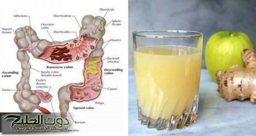 «وداعا للبراز المتحجر والم القولون»... شابّة أردنية تكشف عن أعشاب طبيعية فعّالة لتنظيف القولون وتحسين وظائف الجهاز الهضمي